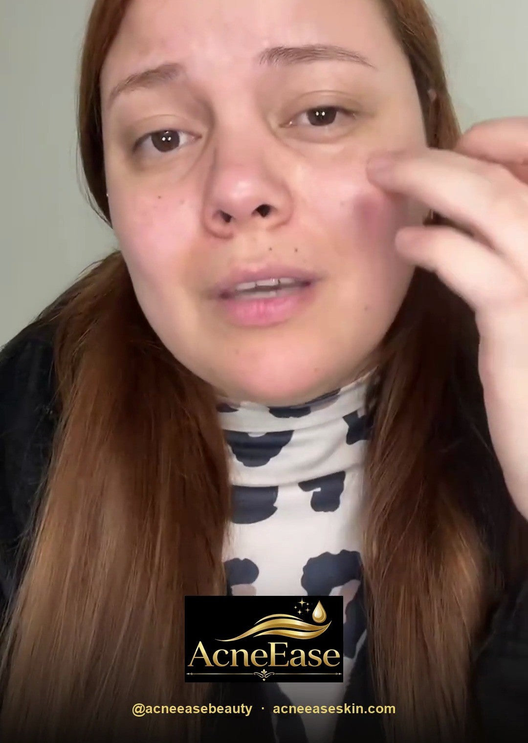 Real customer after using gold under-eye patches — video review