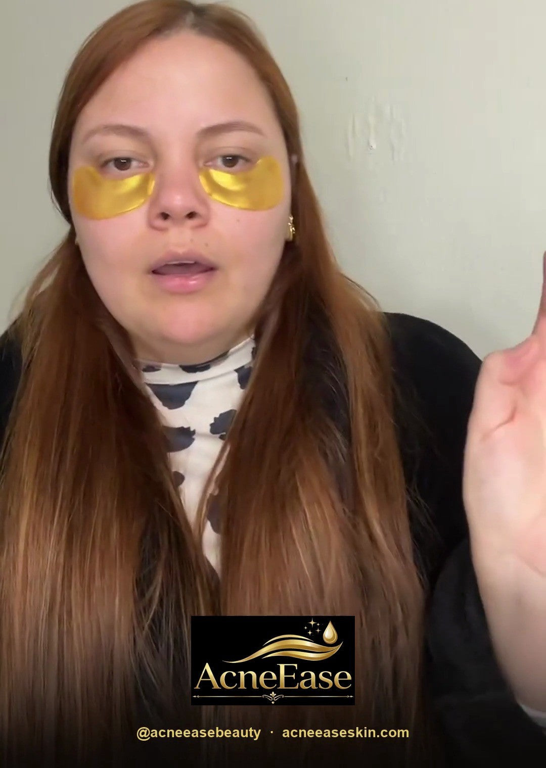 Real customer wearing AcneEase gold under-eye patches — video review