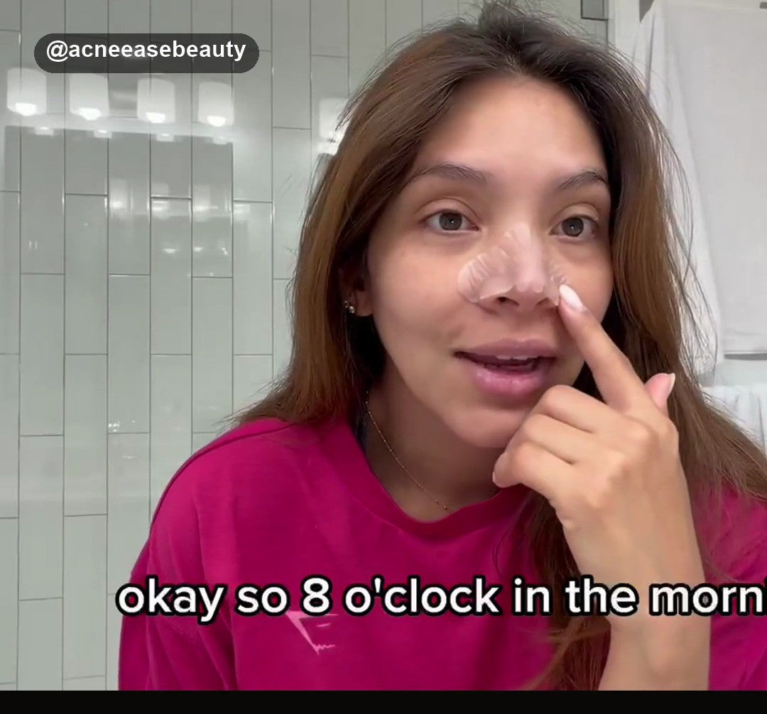Real customer 8 AM morning-after nose patch check — video review