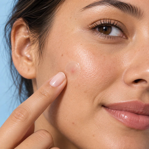 Applying an AcneEase pimple patch to a spot on the cheek
