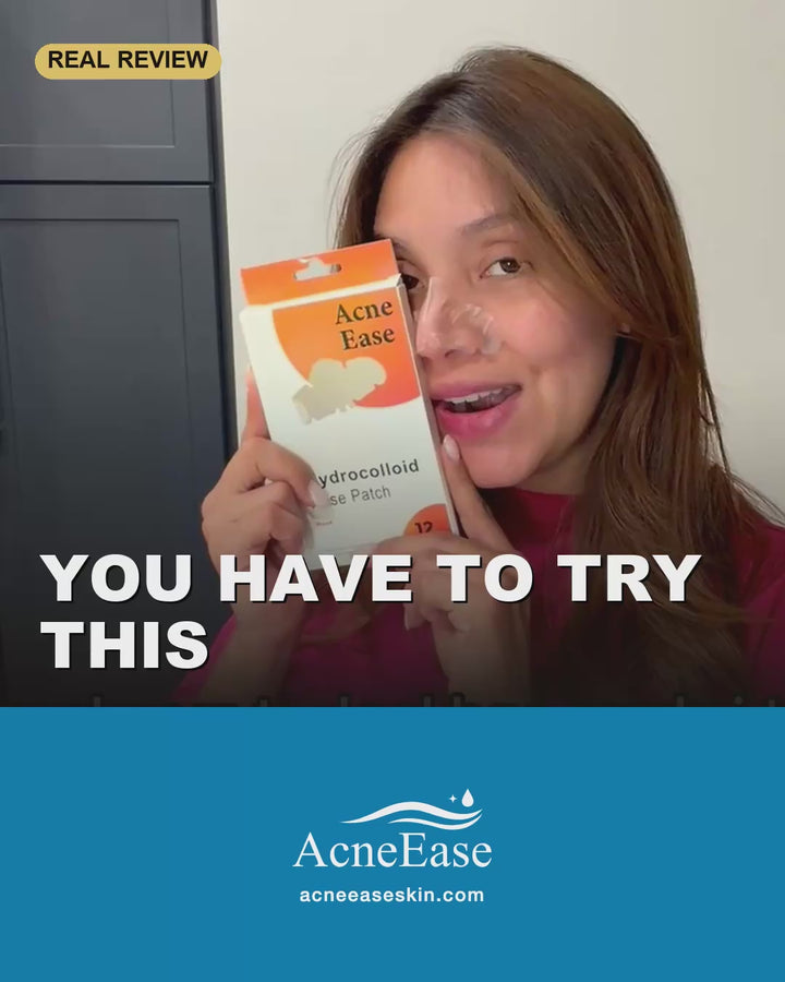 Real customer video review — AcneEase hydrocolloid nose patches overnight
