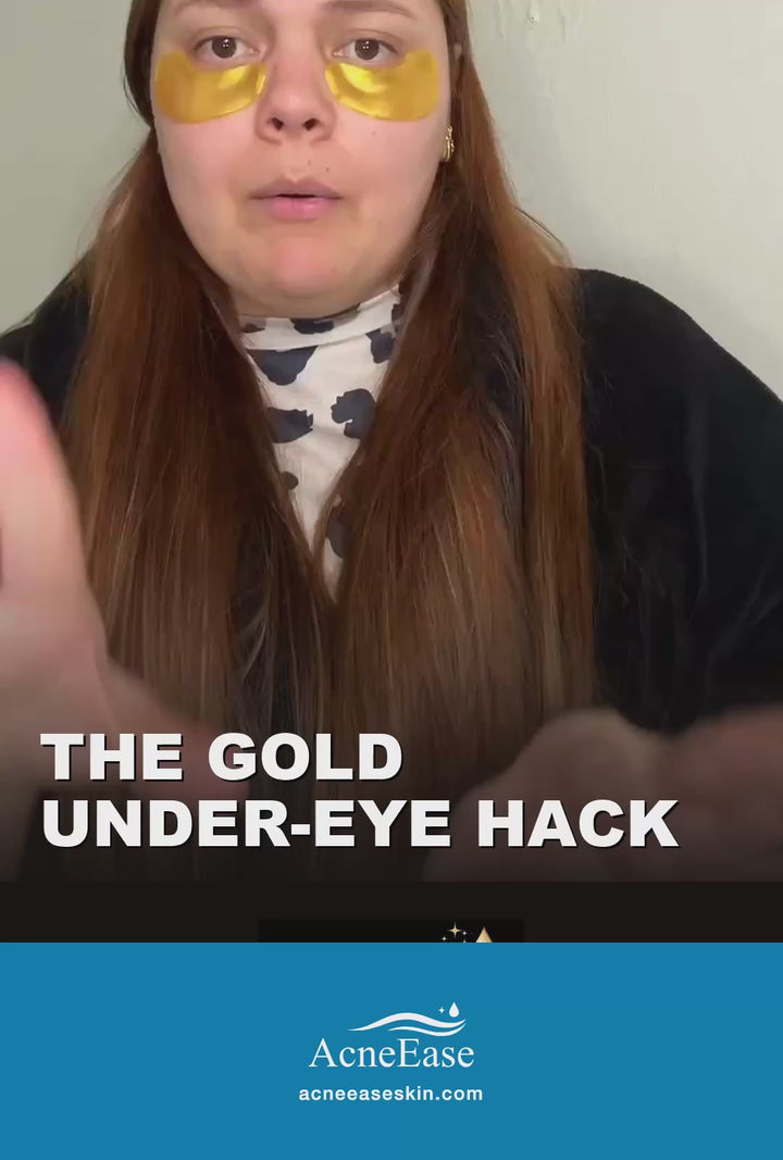 Real customer video review — AcneEase gold collagen under-eye patches