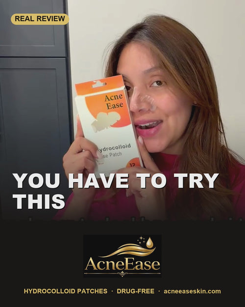 Real customer video review — AcneEase hydrocolloid nose patches overnight
